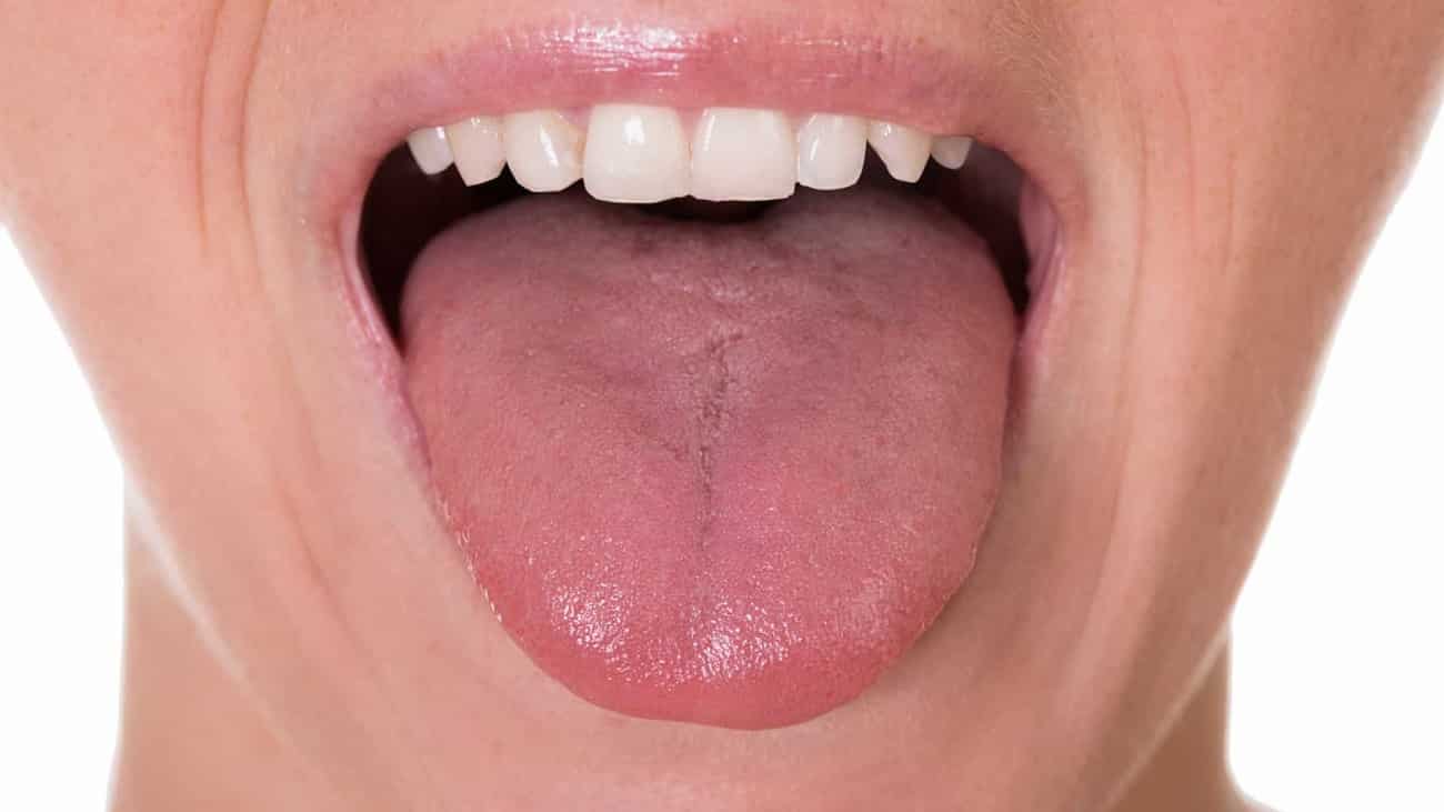 Por que a língua fica branca?